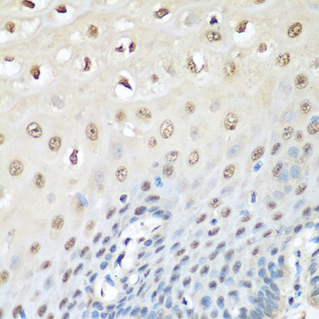 Immunohistochemistry of paraffin-embedded Human esophagus using VCP Polyclonal Antibody at dilution of  1:200 (40x lens).