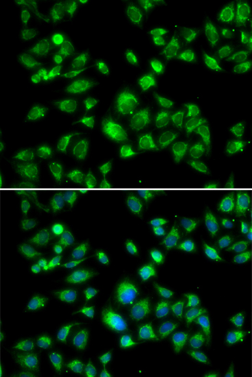 Immunofluorescence analysis of U2OS cells using MBTPS1 Polyclonal Antibody