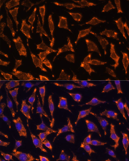 Immunofluorescence analysis of L929 cells using TNFRSF11A Polyclonal Antibody at dilution of  1:100 (40x lens). Blue: DAPI for nuclear staining.