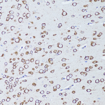 Immunohistochemistry of paraffin-embedded Mouse brain using TNFRSF11A Polyclonal Antibody at dilution of  1:100 (20x lens).