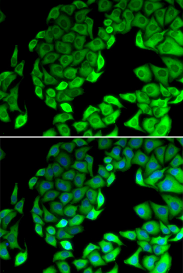 Immunofluorescence analysis of MCF-7 cells using RPL14 Polyclonal Antibody