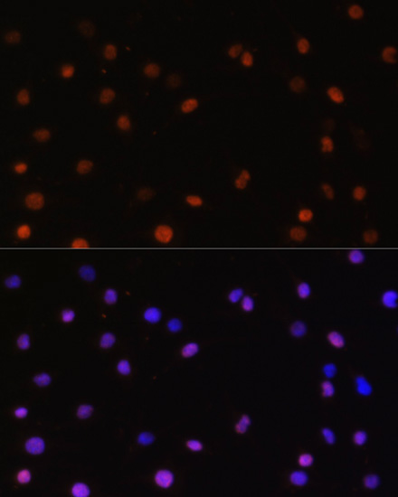 Immunofluorescence analysis of C6 cells using COPS5 Polyclonal Antibody at dilution of  1:100. Blue: DAPI for nuclear staining.