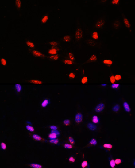 Immunofluorescence analysis of NIH/3T3 cells using COPS5 Polyclonal Antibody at dilution of  1:100. Blue: DAPI for nuclear staining.