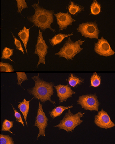 Immunofluorescence analysis of L929 cells using RIG-I / DDX58 Polyclonal Antibody at dilution of  1:100. Blue: DAPI for nuclear staining.