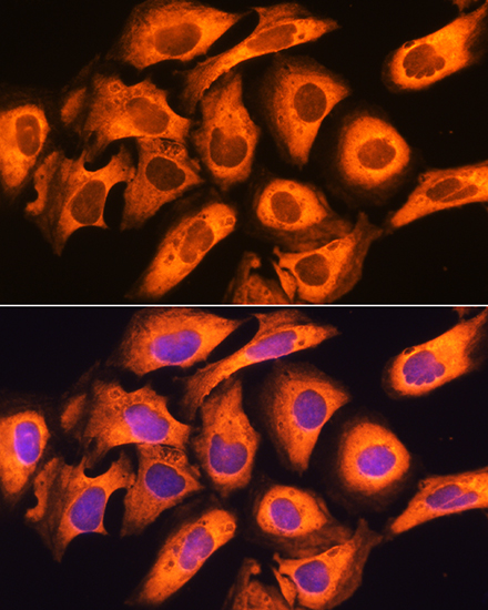 Immunofluorescence analysis of U20S cells using RIG-I / DDX58 Polyclonal Antibody at dilution of  1:100. Blue: DAPI for nuclear staining.
