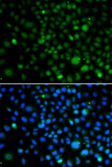 Immunofluorescence analysis of A549 cells using KLF15 Polyclonal Antibody
