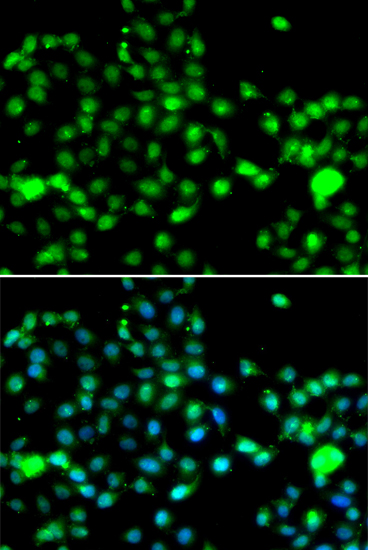 Immunofluorescence analysis of A549 cells using IP6K2 Polyclonal Antibody