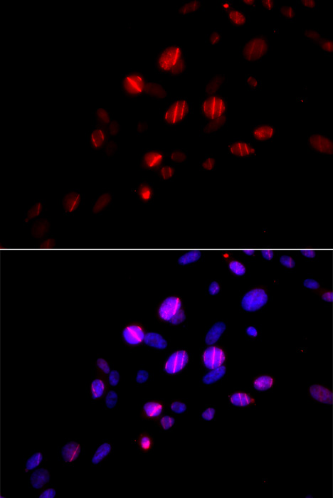 Immunofluorescence analysis of U2OS cells using RAD18 Polyclonal Antibody