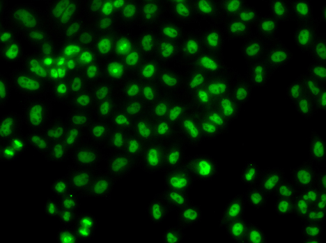 Immunofluorescence analysis of HeLa cells using LHX8 Polyclonal Antibody
