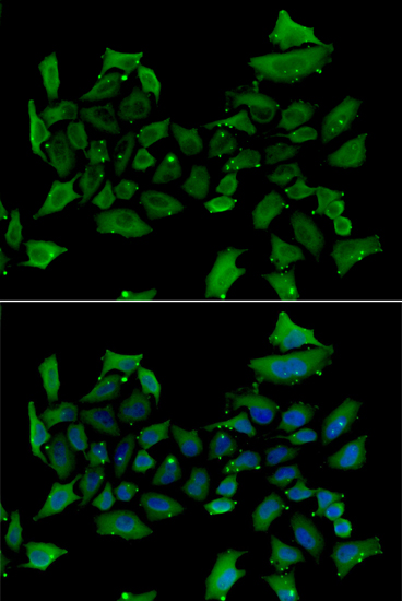 Immunofluorescence analysis of HeLa cells using ALAS1 Polyclonal Antibody