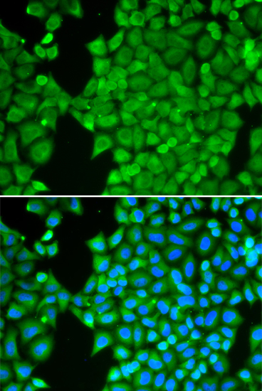 Immunofluorescence analysis of HeLa cells using CA3 Polyclonal Antibody