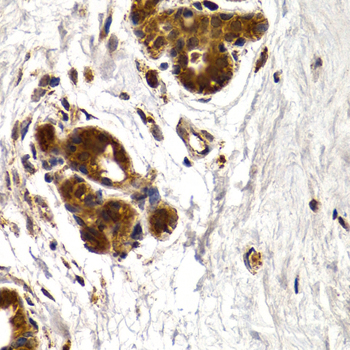 Immunohistochemistry of paraffin-embedded Human mammary gland using CTSS Polyclonal Antibody at dilution of  1:200 (40x lens).