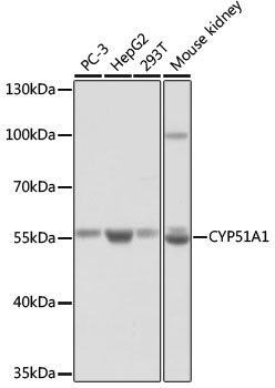 Western blot analysis of extracts of various cell lines using CYP51A1 Polyclonal Antibody at dilution of 1:1000.