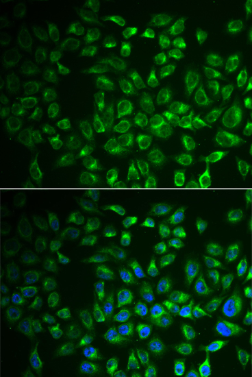 Immunofluorescence analysis of A549 cells using FABP6 Polyclonal Antibody