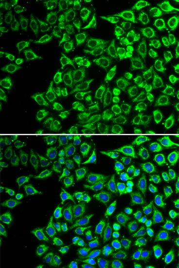 Immunofluorescence analysis of A549 cells using LIPC Polyclonal Antibody
