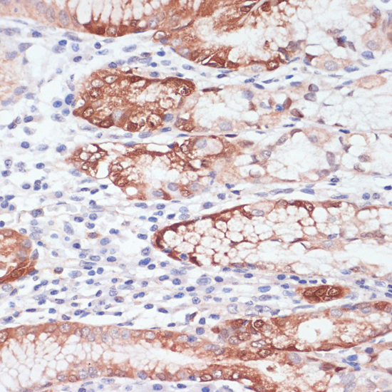 Immunohistochemistry of paraffin-embedded Human stomach using LYZ Polyclonal Antibody at dilution of  1:100 (40x lens).
