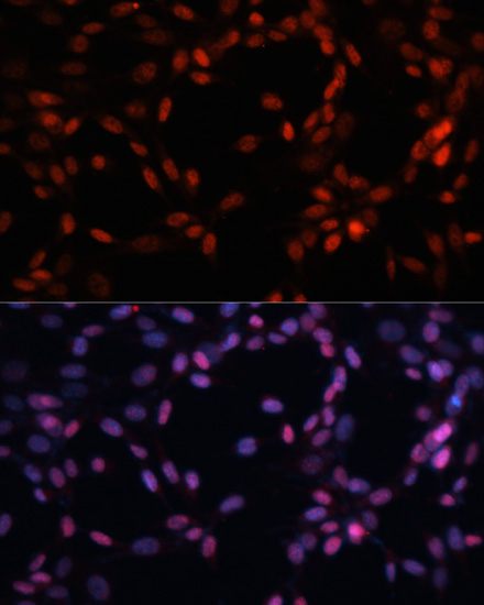 Immunofluorescence analysis of NIH-3T3 cells using MCM5 Polyclonal Antibody at dilution of  1:100. Blue: DAPI for nuclear staining.