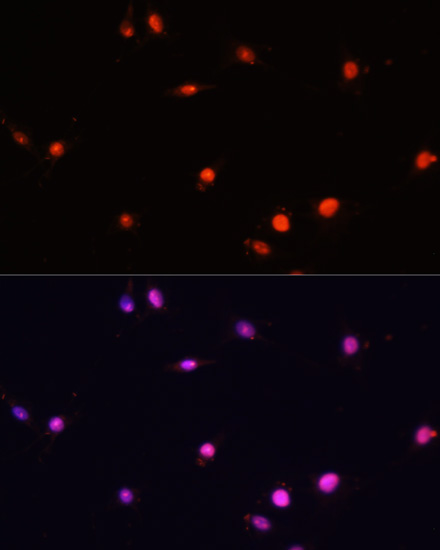 Immunofluorescence analysis of C6 cells using MCM5 Polyclonal Antibody at dilution of  1:100. Blue: DAPI for nuclear staining.