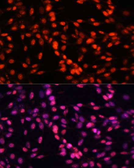 Immunofluorescence analysis of NIH-3T3 cells using MCM5 Polyclonal Antibody at dilution of  1:100. Blue: DAPI for nuclear staining.