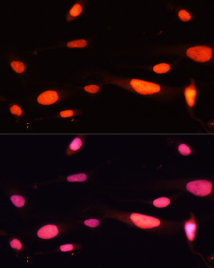 Immunofluorescence analysis of U-2 OS cells using MCM5 Polyclonal Antibody at dilution of  1:100. Blue: DAPI for nuclear staining.