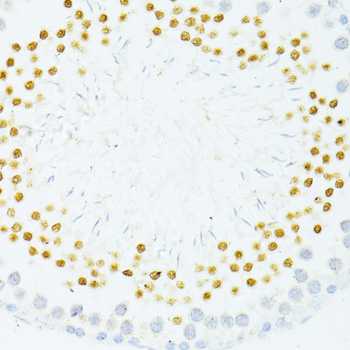 Immunohistochemistry of paraffin-embedded Rat testis using PVALB Polyclonal Antibody at dilution of  1:100 (40x lens).