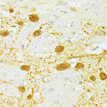 Immunohistochemistry of paraffin-embedded Rat brain using PVALB Polyclonal Antibody at dilution of  1:100 (40x lens).