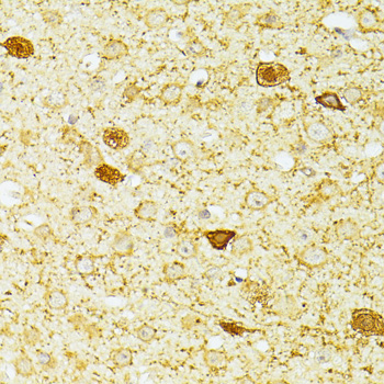 Immunohistochemistry of paraffin-embedded Mouse brain using PVALB Polyclonal Antibody at dilution of  1:100 (40x lens).