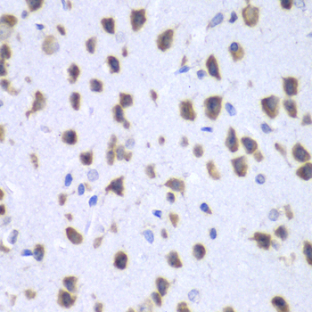 Immunohistochemistry of paraffin-embedded Mouse brain using UPF1 Polyclonal Antibody at dilution of  1:100 (40x lens).