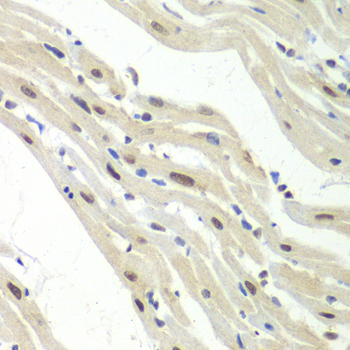 Immunohistochemistry of paraffin-embedded Mouse heart using UPF1 Polyclonal Antibody at dilution of  1:100 (40x lens).