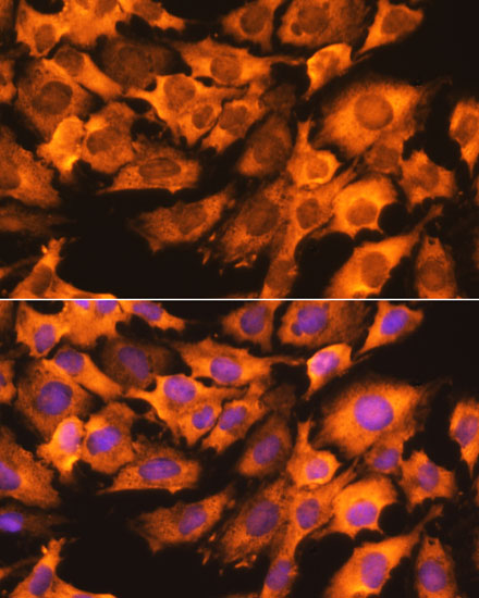 Immunofluorescence analysis of C6 cells using RPS3 Polyclonal Antibody at dilution of  1:100. Blue: DAPI for nuclear staining.