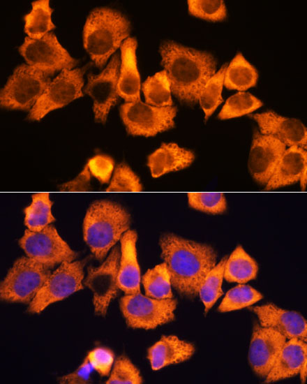 Immunofluorescence analysis of HeLa cells using RPS3 Polyclonal Antibody at dilution of  1:100. Blue: DAPI for nuclear staining.