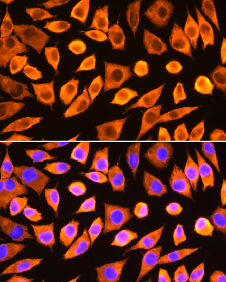 Immunofluorescence analysis of L929 cells using RPS3 Polyclonal Antibody at dilution of  1:100. Blue: DAPI for nuclear staining.