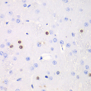 Immunohistochemistry of paraffin-embedded Rat brain using TKT Polyclonal Antibody at dilution of  1:100 (40x lens).