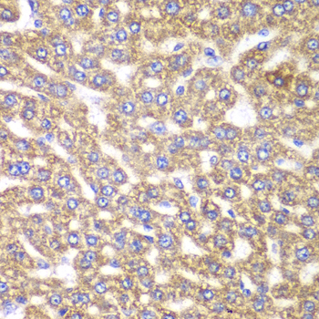 Immunohistochemistry of paraffin-embedded Rat liver using UGDH Polyclonal Antibody at dilution of  1:100 (40x lens).