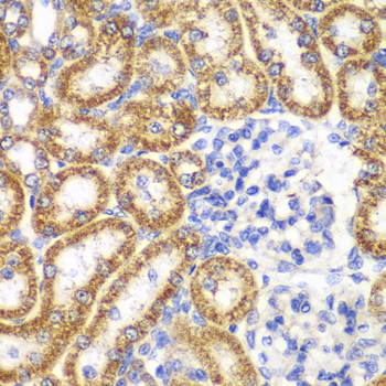 Immunohistochemistry of paraffin-embedded Rat kidney using UGDH Polyclonal Antibody at dilution of  1:100 (40x lens).