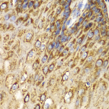 Immunohistochemistry of paraffin-embedded Human esophagus using UGDH Polyclonal Antibody at dilution of  1:100 (40x lens).