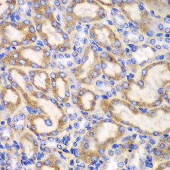 Immunohistochemistry of paraffin-embedded Mouse kidney using UGDH Polyclonal Antibody at dilution of  1:100 (40x lens).