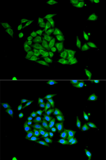 Immunofluorescence analysis of HeLa cells using PICK1 Polyclonal Antibody