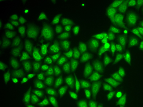 Immunofluorescence analysis of HeLa cells using AKR1A1 Polyclonal Antibody