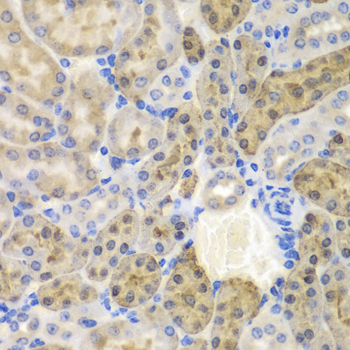 Immunohistochemistry of paraffin-embedded Mouse kidney using AKR1A1 Polyclonal Antibody at dilution of  1:100 (40x lens).