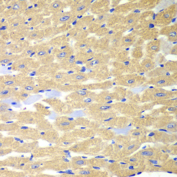 Immunohistochemistry of paraffin-embedded Mouse heart using RPH3A Polyclonal Antibody at dilution of  1:100 (40x lens).