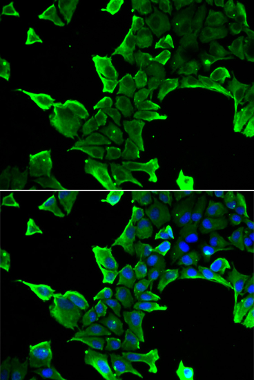 Immunofluorescence analysis of A549 cells using NCS1 Polyclonal Antibody