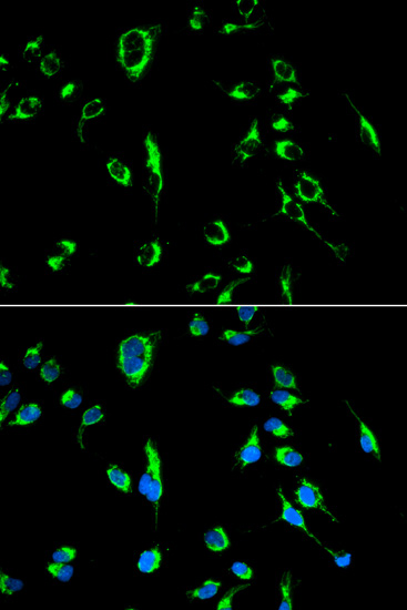 Immunofluorescence analysis of MCF-7 cells using APOBEC3G Polyclonal Antibody