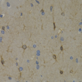 Immunohistochemistry of paraffin-embedded Rat brain using WNT3A Polyclonal Antibody at dilution of  1:200 (40x lens).