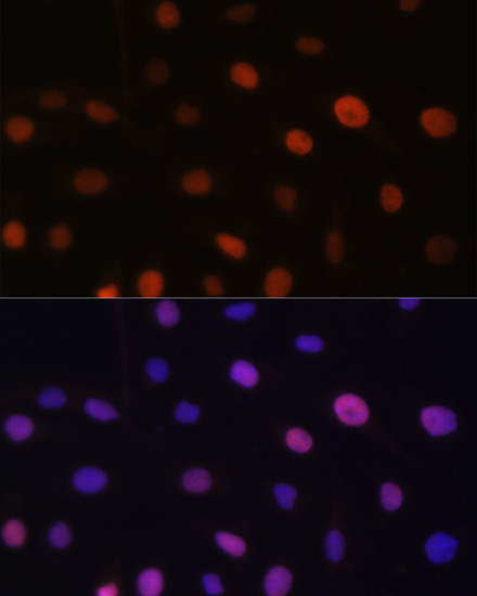 Immunofluorescence analysis of U-2 OS cells using UHRF2 Polyclonal Antibody at dilution of  1:100. Blue: DAPI for nuclear staining.