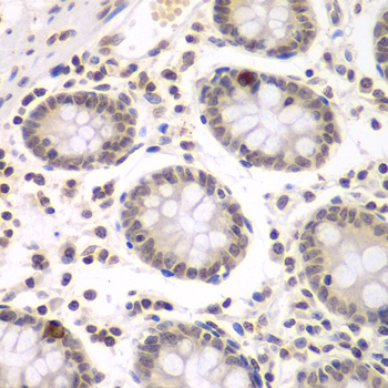 Immunohistochemistry of paraffin-embedded Human colon using UHRF2 Polyclonal Antibody at dilution of  1:200 (40x lens).