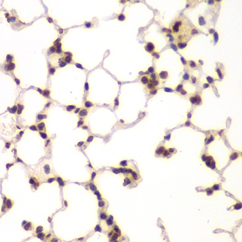 Immunohistochemistry of paraffin-embedded Mouse lung using UHRF2 Polyclonal Antibody at dilution of  1:200 (40x lens).