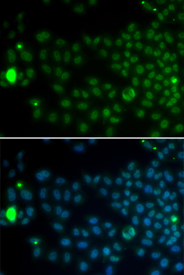 Immunofluorescence analysis of MCF-7 cells using SPDYA Polyclonal Antibody