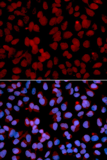 Immunofluorescence analysis of U2OS cells using TNFAIP3 Polyclonal Antibody