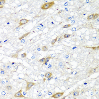 Immunohistochemistry of paraffin-embedded Rat brain using CPA6 Polyclonal Antibody at dilution of  1:100 (40x lens).